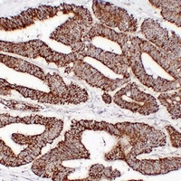 HSP60 Antibody