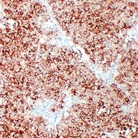 ALPP Antibody