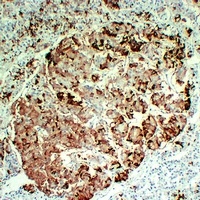 Prolactin Mouse Monoclonal Antibody