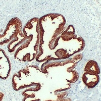 Kallikrein 3 Mouse Monoclonal Antibody