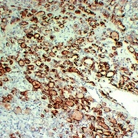Thyroid Peroxidase Mouse Monoclonal Antibody