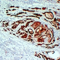 Thyroid Peroxidase Mouse Monoclonal Antibody
