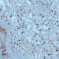 CD14 Antibody