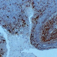 CD14 Antibody