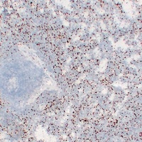 Anti-CD61 Antibody