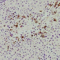 Anti-CD61 Antibody