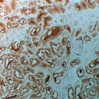 Histone Deacetylase 6 Mouse Monoclonal Antibody