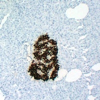 Insulin Mouse Monoclonal Antibody