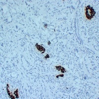 Insulin Mouse Monoclonal Antibody