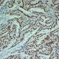 Anti-MLH1 Antibody
