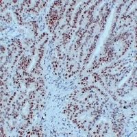 MLH1 antibody