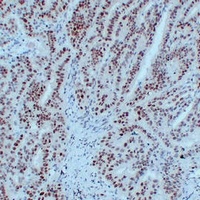 Anti-MLH1 Antibody