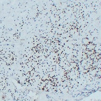 MYOD1 antibody