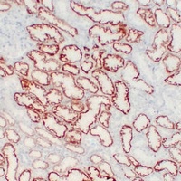Von Hippel Lindau Mouse Monoclonal Antibody