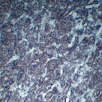 Anti-Wilms Tumor 1 Antibody