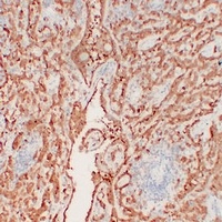 Calretinin antibody