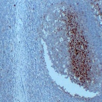 Anti-CD14 Antibody