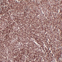 CD1a Mouse Monoclonal Antibody