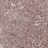 CD1a Mouse Monoclonal Antibody