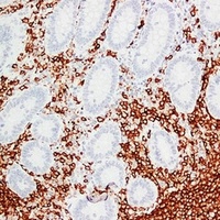 CD20 Mouse Monoclonal Antibody