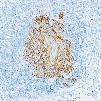 CD23 Mouse Monoclonal Antibody