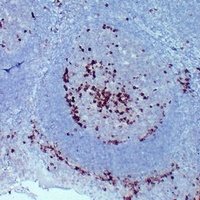 CD38 Antibody