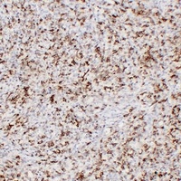 CD43 Mouse Monoclonal Antibody