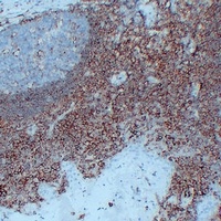 CD44 Antibody