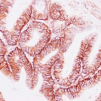 CD44 Antibody