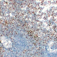 Anti-CD61 Antibody