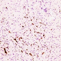 Anti-CD61 Antibody