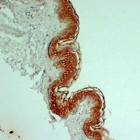Cytokeratin 1 Mouse Monoclonal Antibody