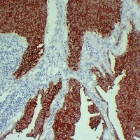 Cytokeratin 13 Mouse Monoclonal Antibody