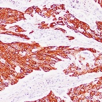 Cytokeratin 13 Mouse Monoclonal Antibody