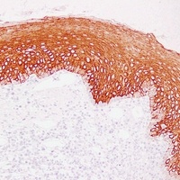 Cytokeratin 13 Mouse Monoclonal Antibody