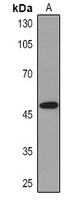 Cytokeratin 13 Antibody