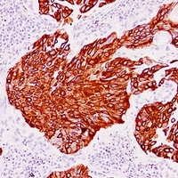 Cytokeratin 13 antibody