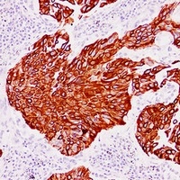 Anti-Cytokeratin 13 Antibody