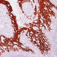 Cytokeratin 13 antibody