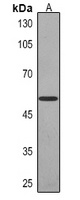 Cytokeratin 14 Antibody