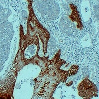 Cytokeratin 14 antibody