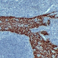 Cytokeratin 14 antibody