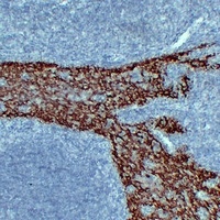 Anti-Cytokeratin 14 Antibody