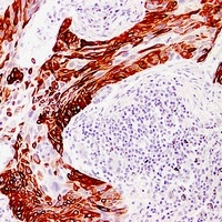 Anti-Cytokeratin 14 Antibody
