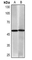 Cytokeratin 17 Mouse Monoclonal Antibody