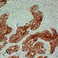 Cytokeratin 17 Mouse Monoclonal Antibody