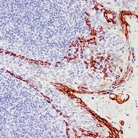 Cytokeratin 17 Mouse Monoclonal Antibody