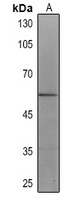 Cytokeratin 6 Mouse Monoclonal Antibody
