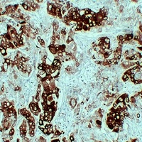 Cytokeratin 6 Mouse Monoclonal Antibody