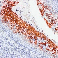 Cytokeratin 6 antibody